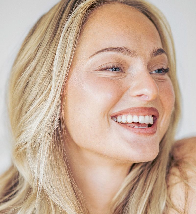 Leende kvinna efter behandling med Invisalign